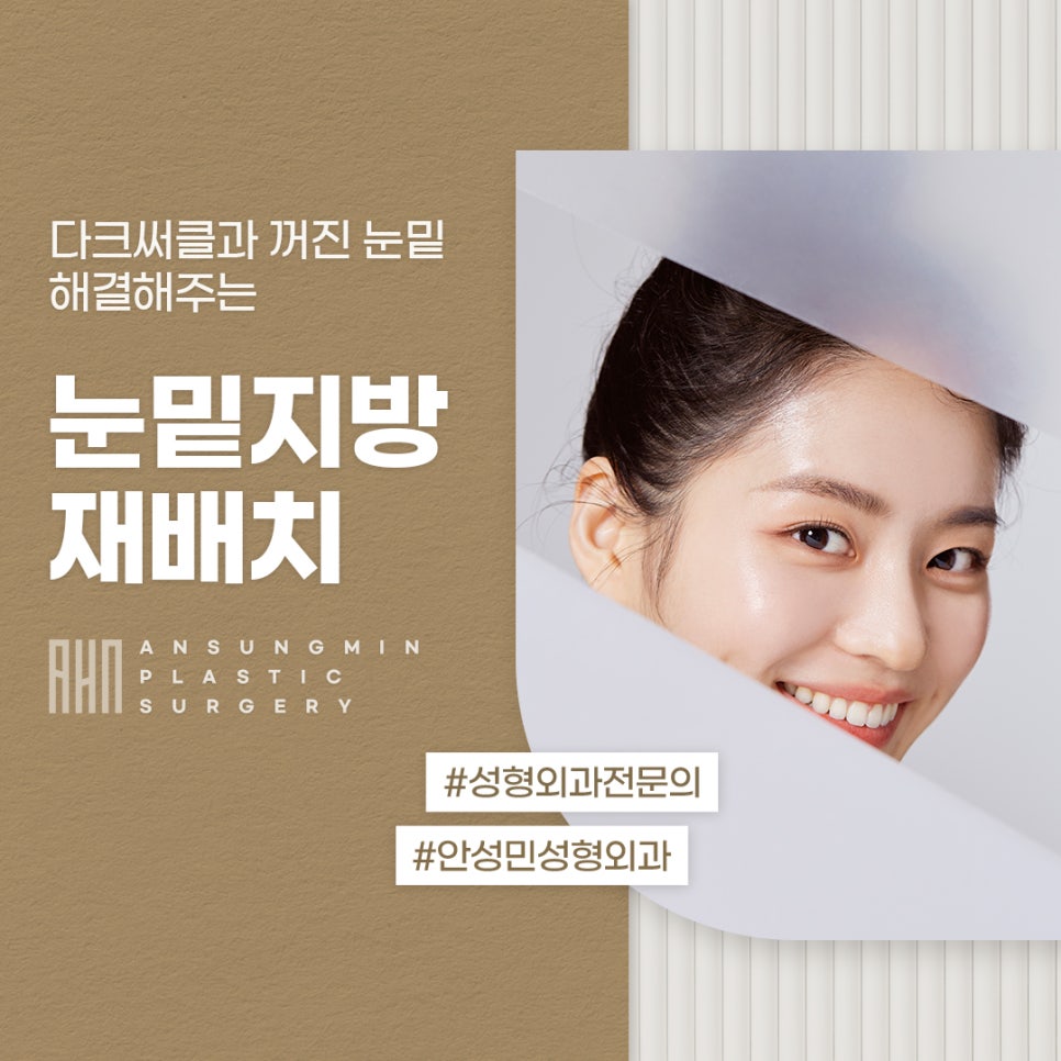 삼성성형외과 눈밑지방재배치로 답답한 인상 탈출 관련 이미지 1