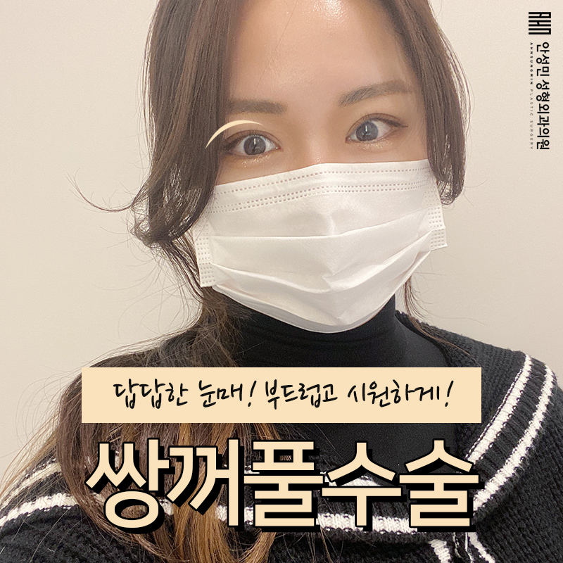 [잠실동성형외과] 결과로 증명하는 눈매교정 맛집! 매력적이게! 잠실성형외과 관련 이미지 1