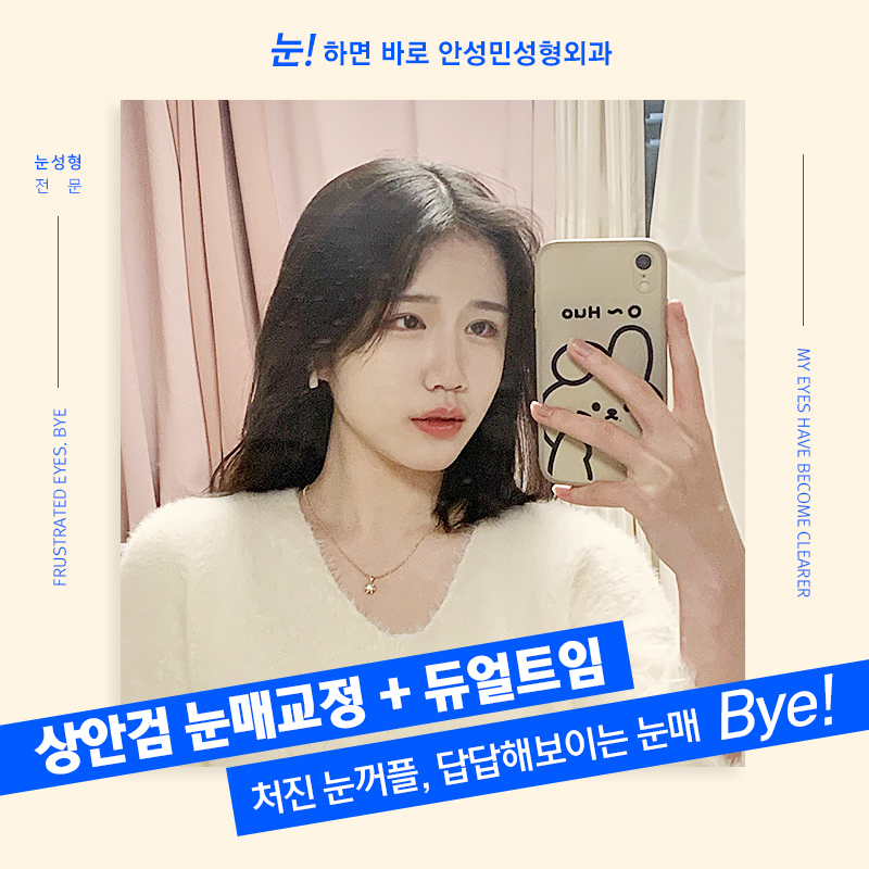 [잠실동성형외과] 포토샵처럼 내 눈에 꼭 맞게! 답답한 눈 NO! 시원한 눈 OK! 잠실성형외과 관련 이미지 1