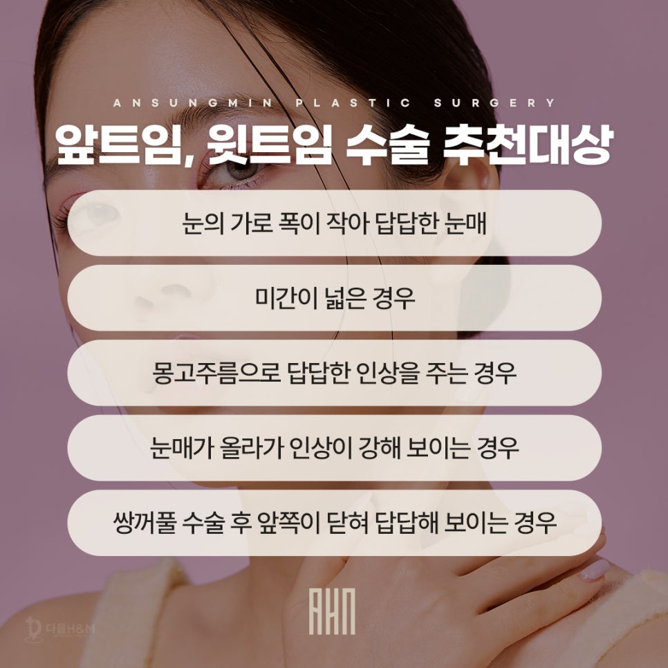송파구 성형외과 트임성형 후기 많은 이유 관련 이미지 5