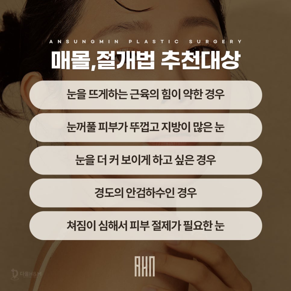 잠실새내역 성형외과 눈매교정 전문 관련 이미지 3