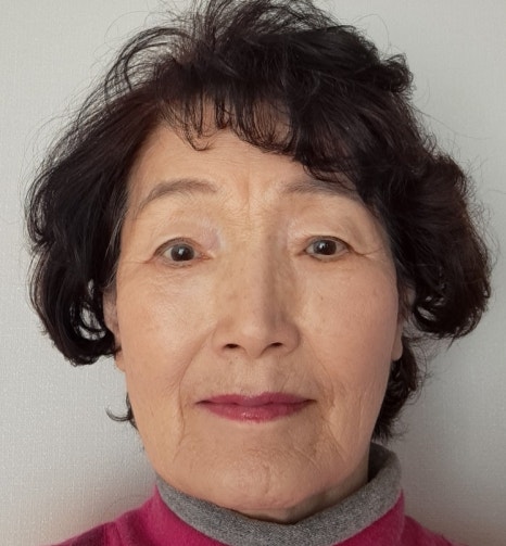 70대 여성 눈 밑 하안검 수술 회복 리얼 후기 관련 이미지 8