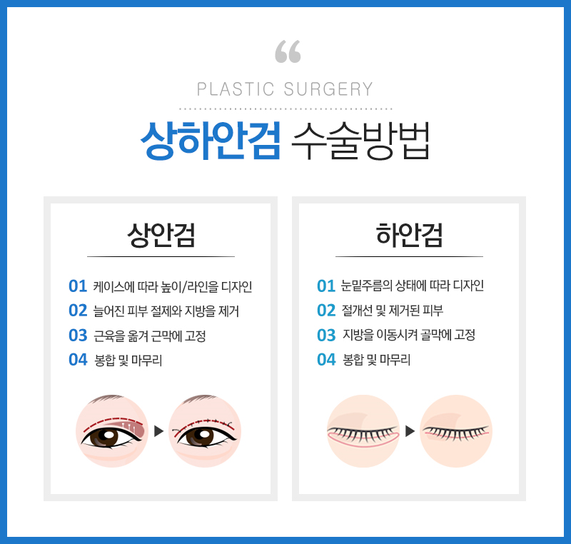 잠실성형외과 관련 이미지 4