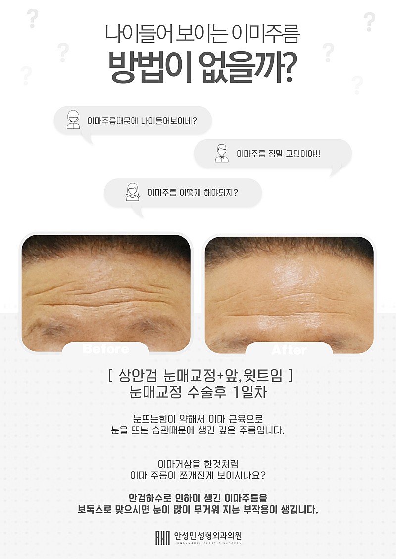 금방 늙어버리는 내이마 방법이 없을까? 관련 이미지 2