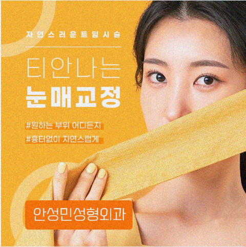 눈매교정 관련 이미지 1
