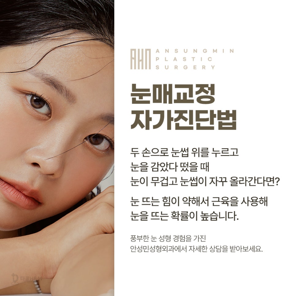 눈매교정잘하는곳 안성민성형외과 관련 이미지 4
