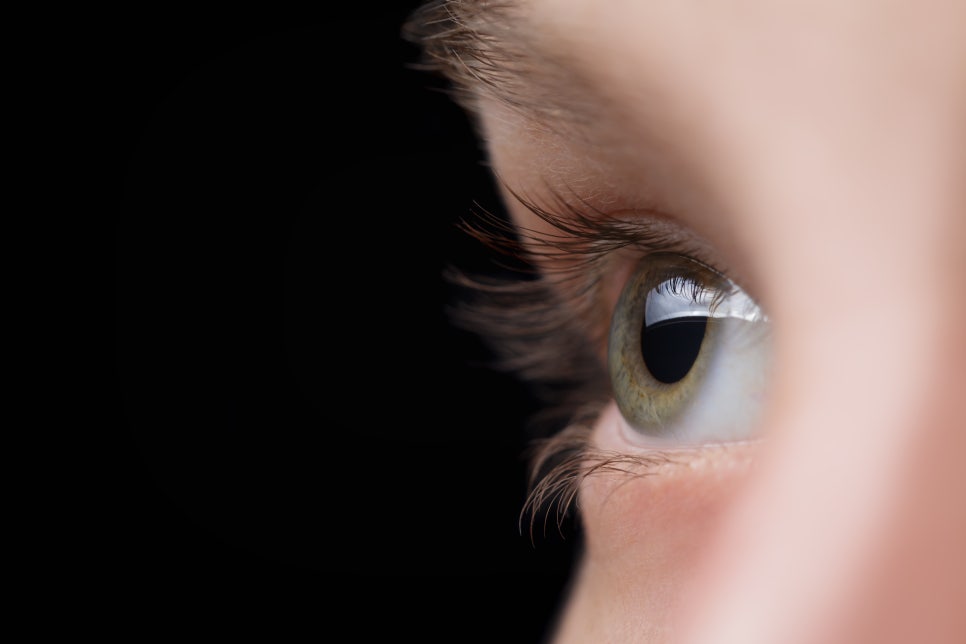 뒷트임복원, 올바른 시기와 뒷트임 복원 전후 관련 이미지 3