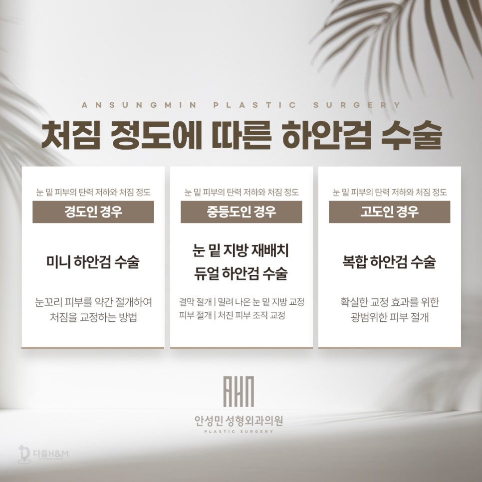 송파구 성형외과 하안검 수술 원한다면, 안성민성형외과 관련 이미지 4