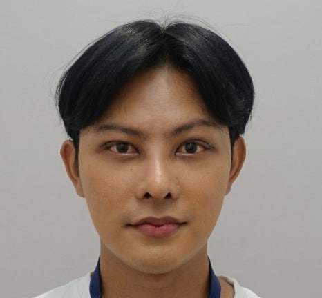 느끼한 남자 눈 무쌍이 되고 싶어요. 두꺼운 쌍꺼풀 낮추기 관련 이미지 9