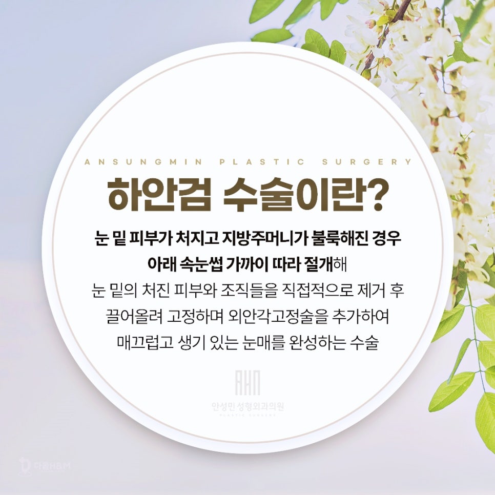 송파구눈성형 하안검 수술을 받는 이유 관련 이미지 2