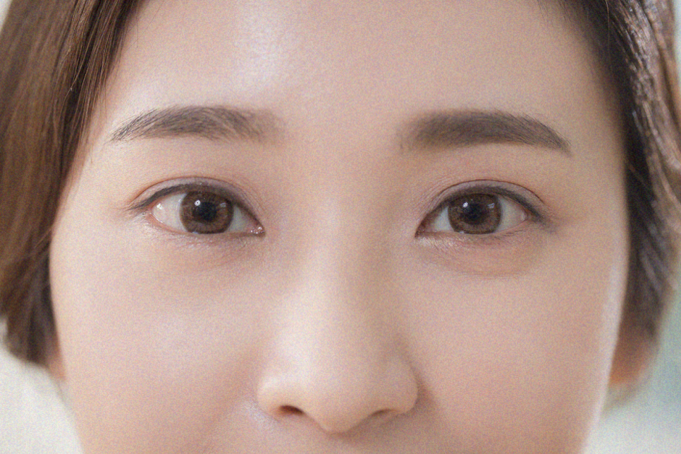 쌍수가격 내 눈에 맞는 방법은? 관련 이미지 10