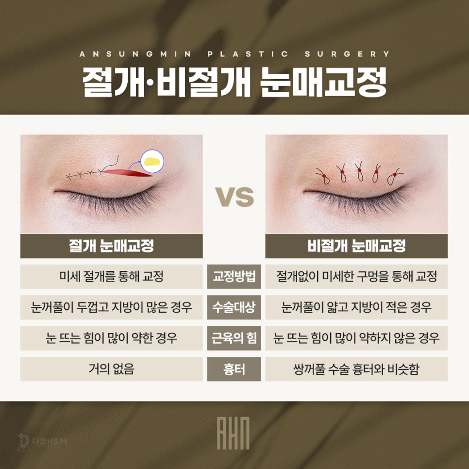 눈매교정잘하는곳 안성민성형외과 관련 이미지 3