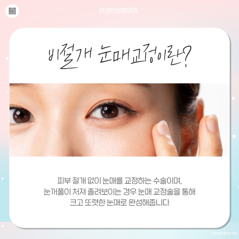 쌍수 어울림에 대한 기준을 세워 관련 이미지 9