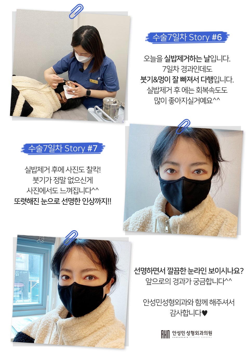 [잠실동성형외과] 오늘의일상story 잠실성형외과 관련 이미지 3