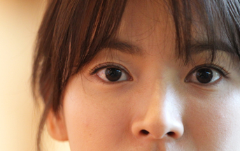 뒷트임 후 눈뜨기가 쉬워요 [성형외과 전문의 안성민] 관련 이미지 6