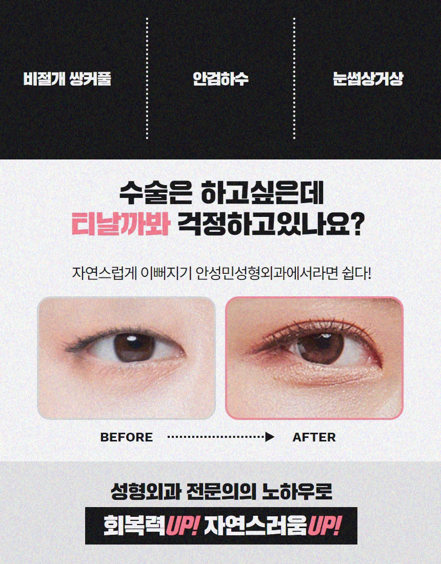 눈꺼풀처짐 노안이미지로 걱정이라면 관련 이미지 2