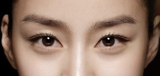 뒷트임 후 눈뜨기가 쉬워요 [성형외과 전문의 안성민] 관련 이미지 3