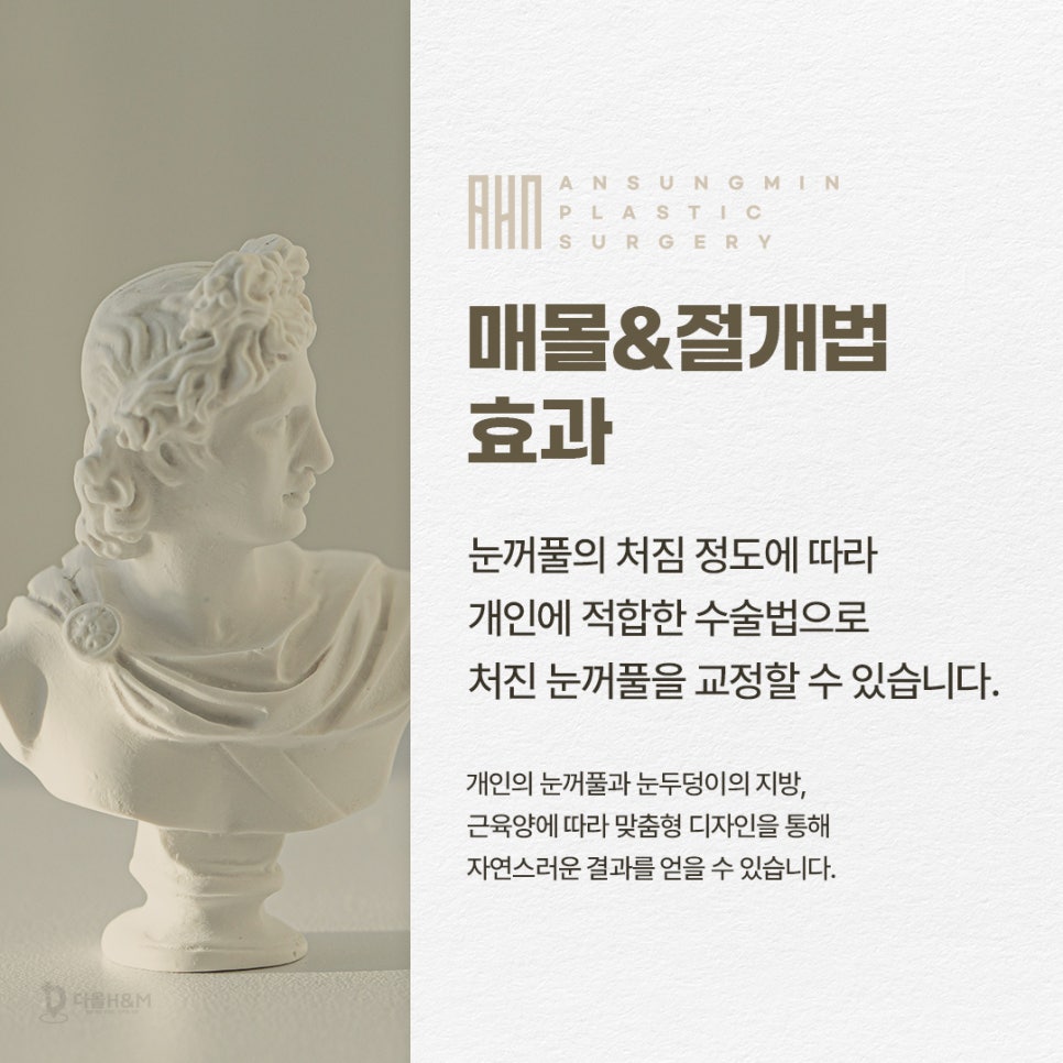 잠실새내역 성형외과 눈매교정 전문 관련 이미지 4