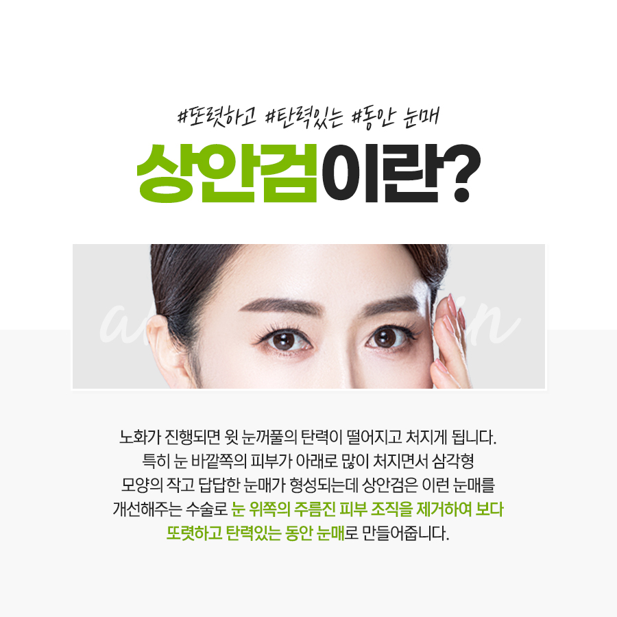 상안검수술은 이럴 때 고민하세요~ 관련 이미지 2