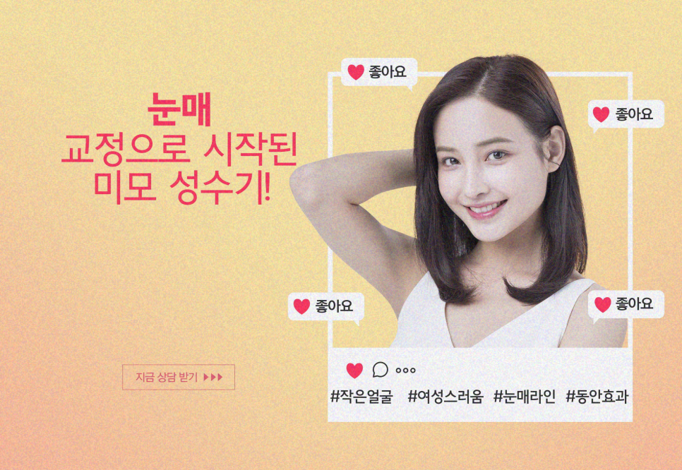 뒷트임 뒷내림 시원하고 선해 보이는 눈매교정 관련 이미지 9