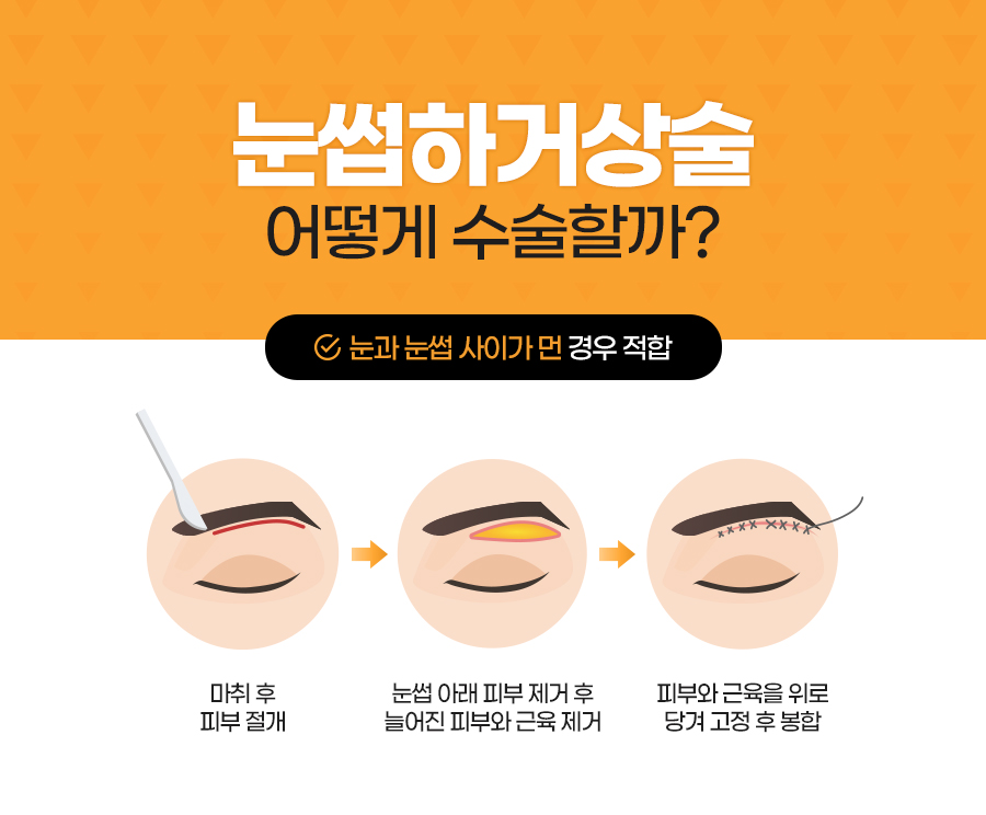 잠실성형외과 관련 이미지 5