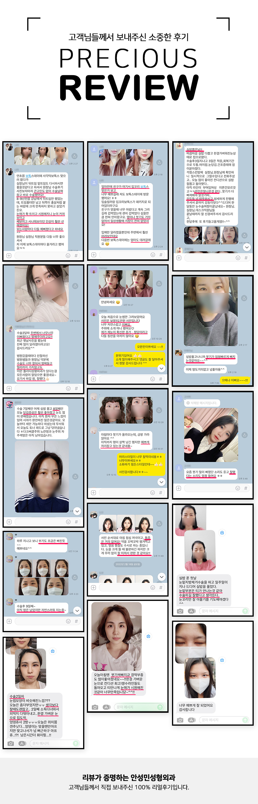 [잠실동성형외과] 고객님들께서 보내주신 솔직! 리얼! 후기입니다 / 잠실 안성민성형외과 관련 이미지 1