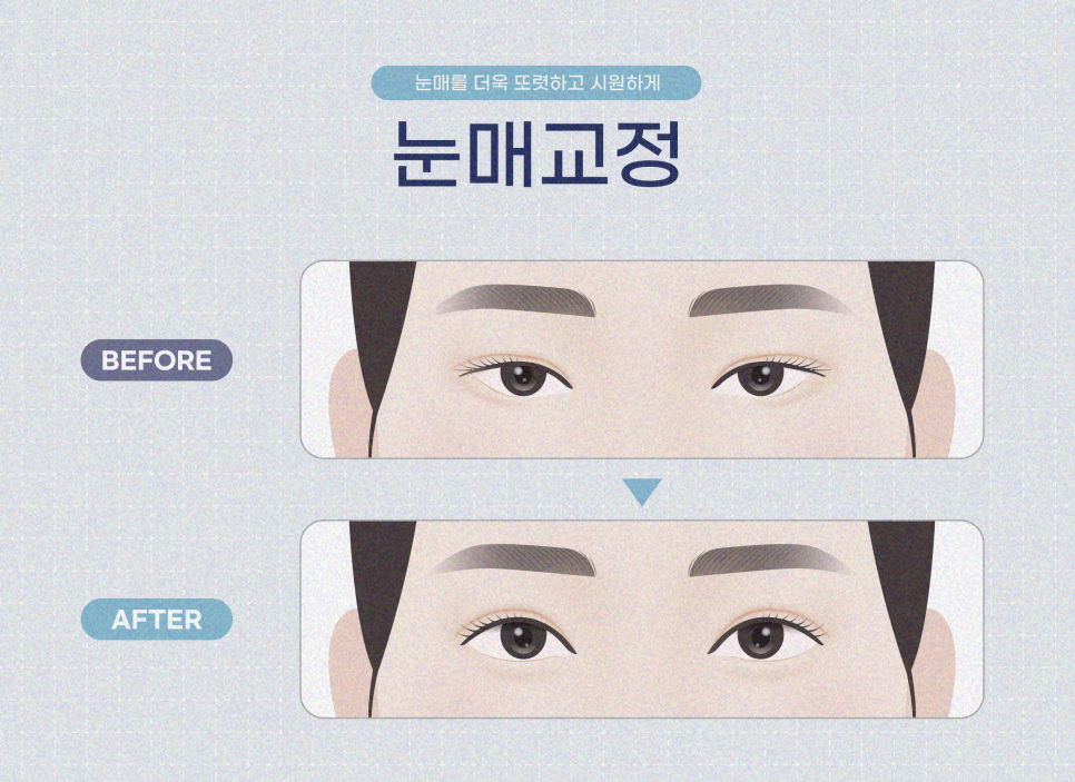 앞트임 포인트를 살려야 관련 이미지 9