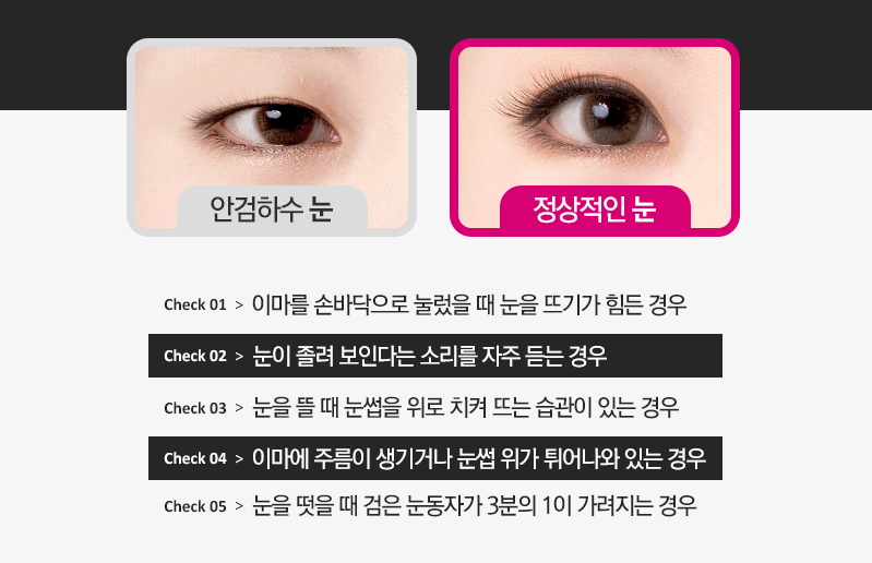 잠실성형외과 관련 이미지 2