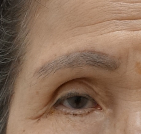 꺼진 눈 나이 들어 보이는 이유, 꺼진 눈 해결 방법 관련 이미지 3