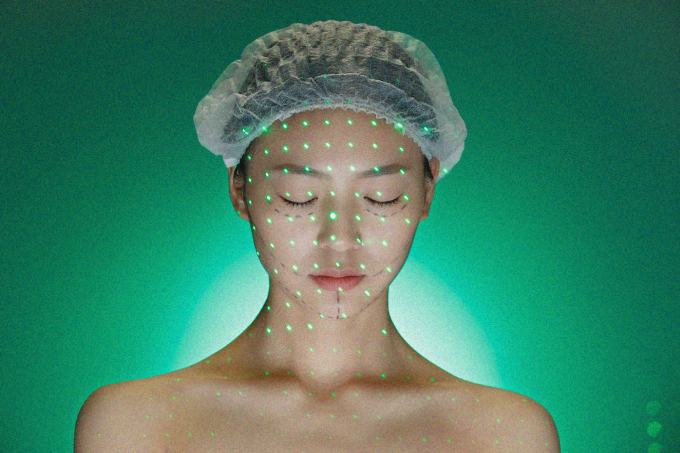 쌍수가격 내 눈에 맞는 방법은? 관련 이미지 8