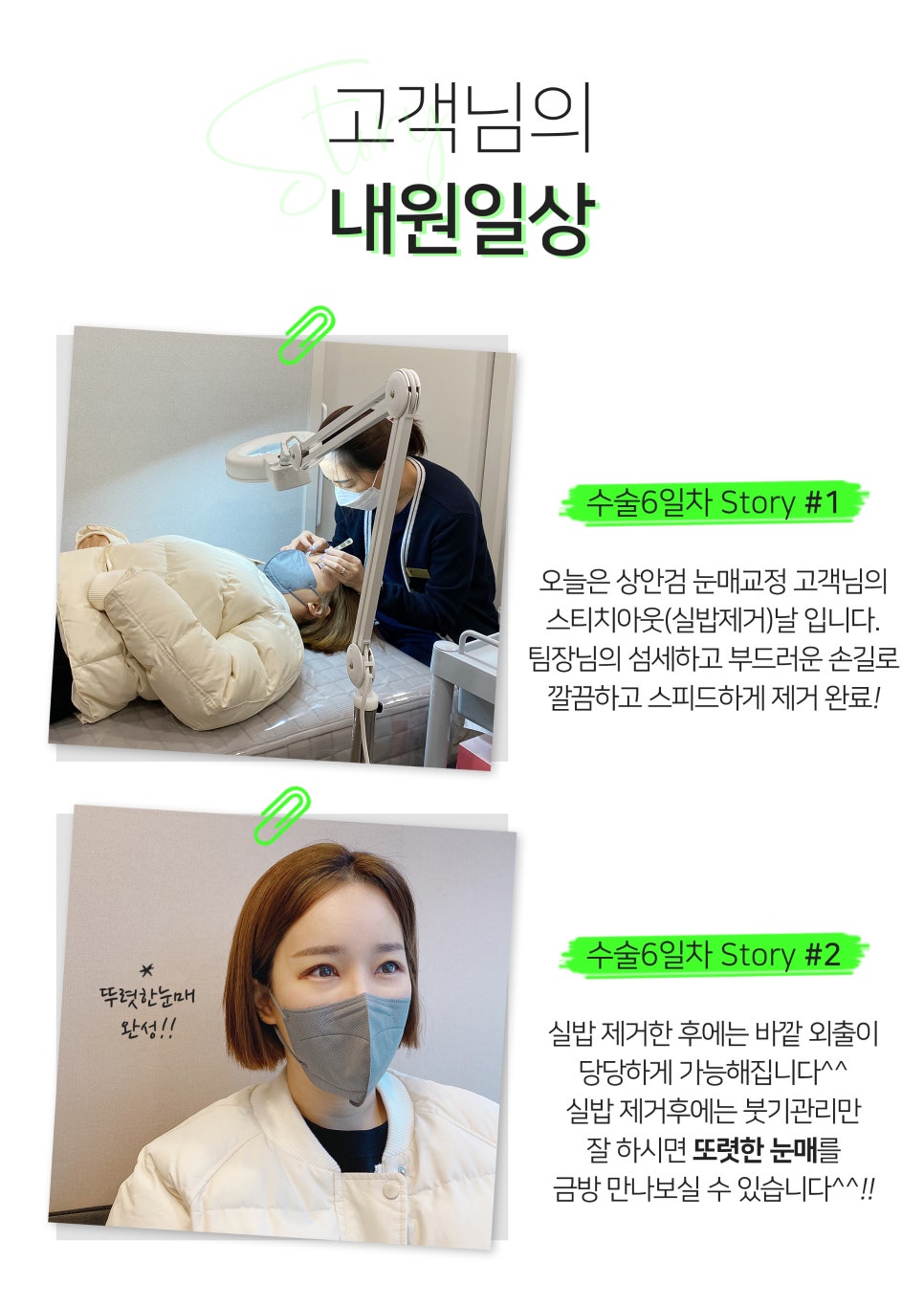 [잠실동성형외과] 오늘의일상 Story 관련 이미지 1