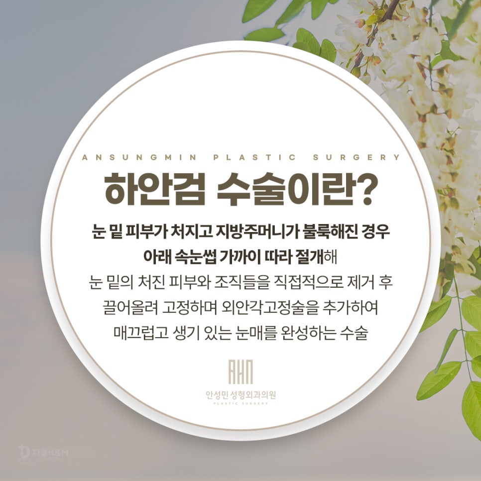 눈재수술전문 병원에서 말하는 하안검이란? 관련 이미지 2