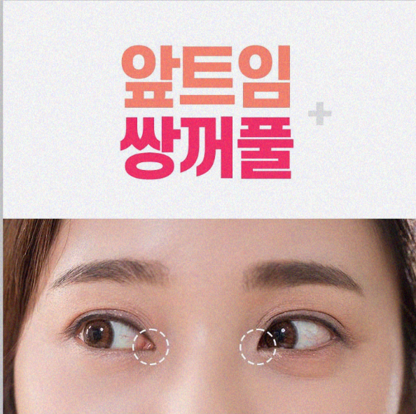 쌍꺼풀수술비용 만족스러운 변화를 관련 이미지 1