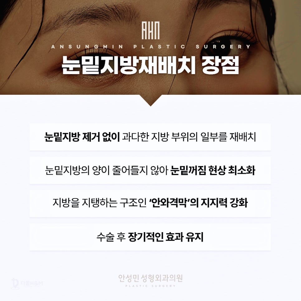 삼성성형외과 눈밑지방재배치로 답답한 인상 탈출 관련 이미지 3