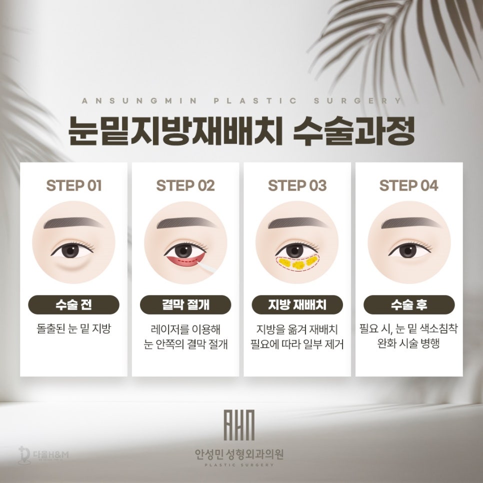 눈밑지방재배치 추천대상을 중년눈성형 전문 성형외과에서 알려드립니다. 관련 이미지 4