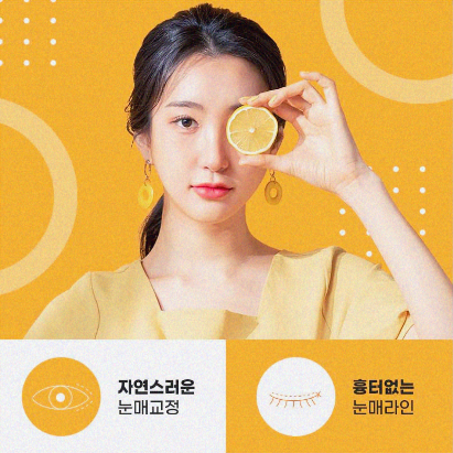 비절개눈매교정 가능한 케이스는? 관련 이미지 5