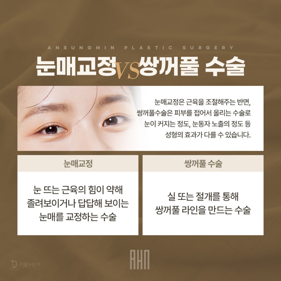 눈매교정잘하는곳 안성민성형외과 관련 이미지 2
