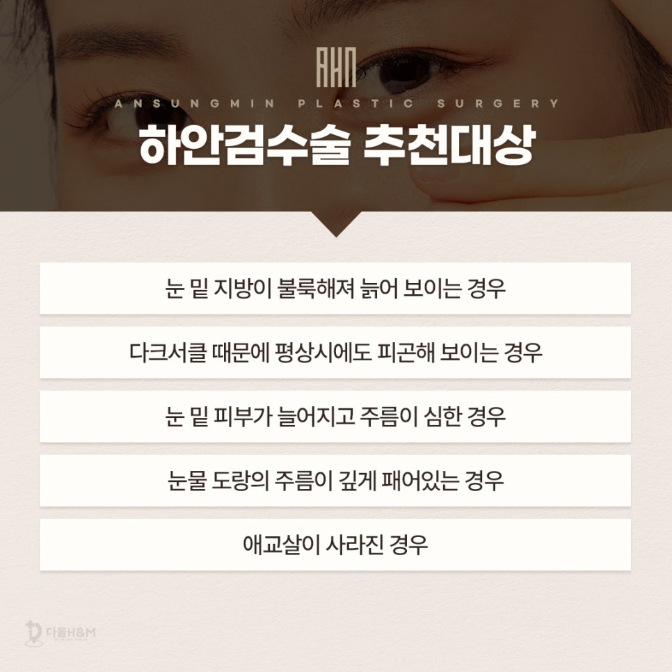 눈재수술전문 병원에서 말하는 하안검이란? 관련 이미지 3