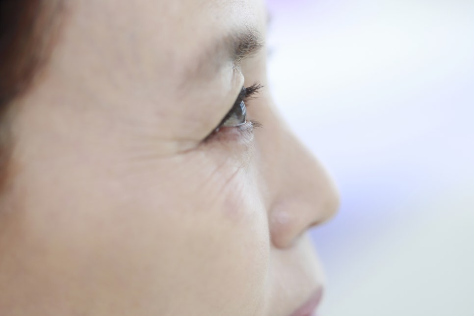 잘하는 하안검수술 성형외과 선택 기준 관련 이미지 2