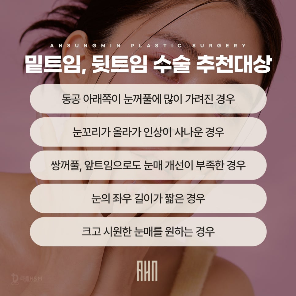 송파구 성형외과 트임성형 후기 많은 이유 관련 이미지 6