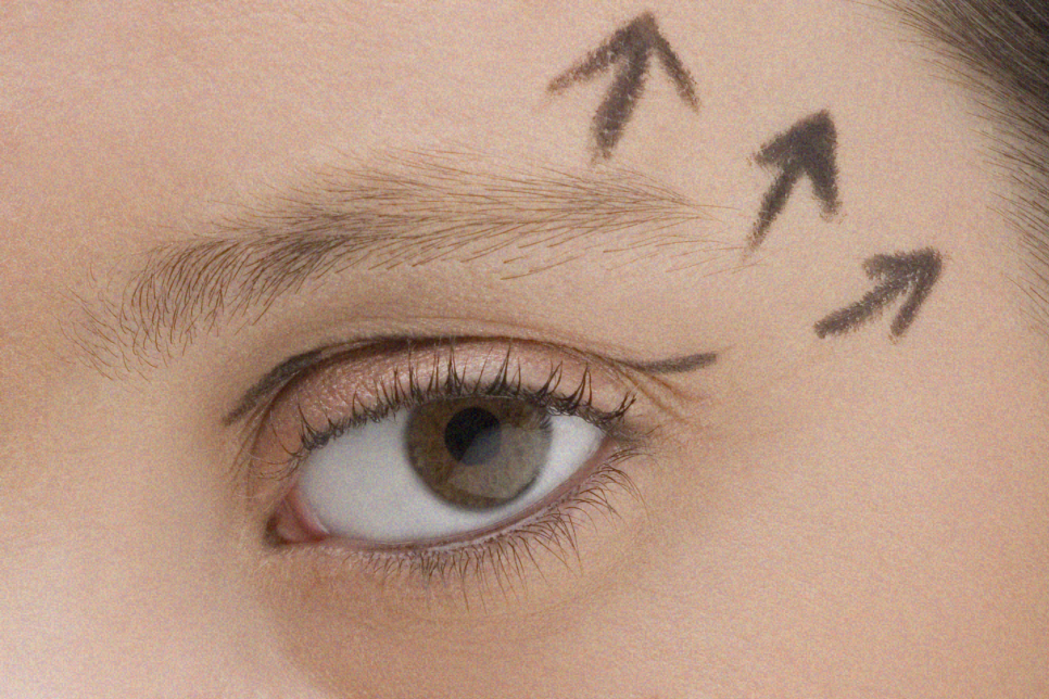 뒷트임 뒷내림 시원하고 선해 보이는 눈매교정 관련 이미지 7