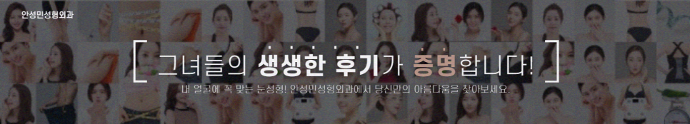 눈재수술 잘하는곳 고르는 포인트는? 관련 이미지 10