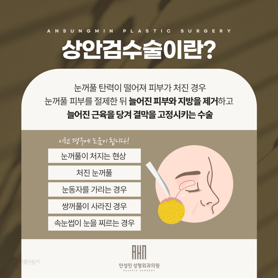 안검하수 문제를 해결하는 상안검수술잘하는성형외과 관련 이미지 2