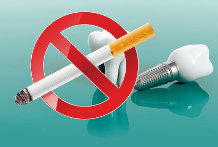 임플란트시술주의사항, 모르면 10년 못 쓰는 이유 관련 이미지 4