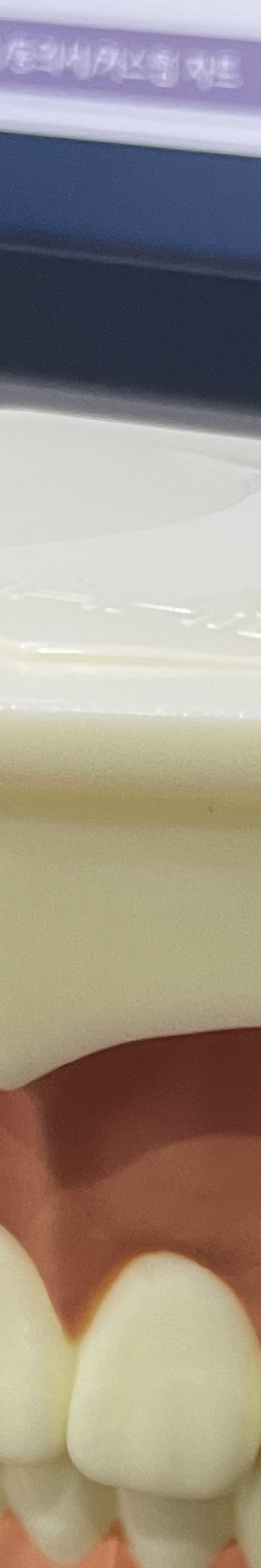 양재역 치과, 실력과 양심 두마리 토끼를 놓치지 않는 방법 관련 이미지 13