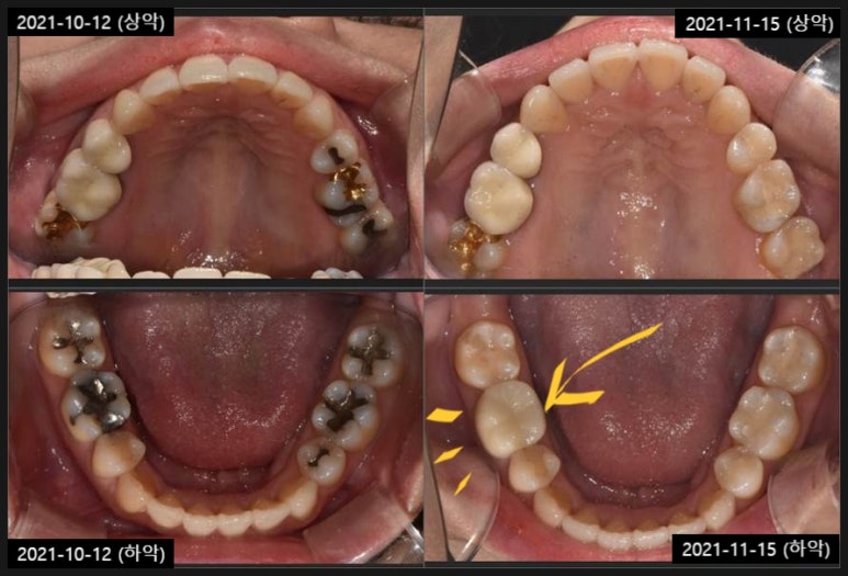 언주역치과, 의사 실력 모르겠다면? OO부터... 관련 이미지 4