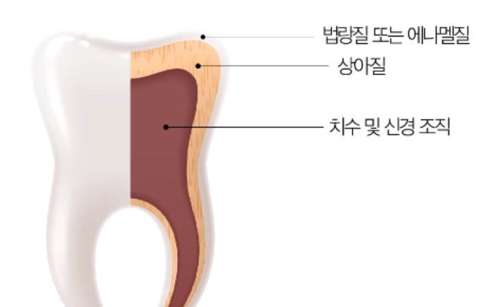 면접 전 치아미백, 꼭 알고 받으세요. 관련 이미지 3