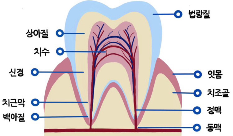 치아파절, 실체를 낱낱이 파헤쳐드립니다. 관련 이미지 2