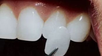 라미네이트 실패원인, 일상생활에서 주의할 2가지 관련 이미지 4