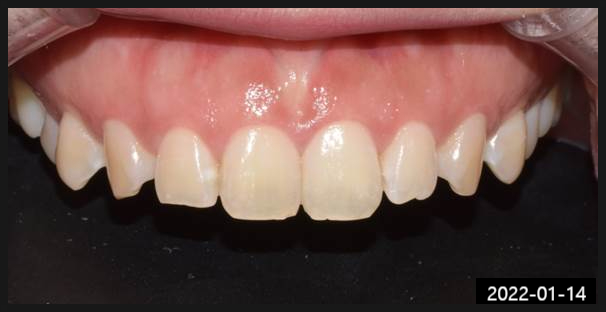 언주역치과, 의사 실력 모르겠다면? OO부터... 관련 이미지 6